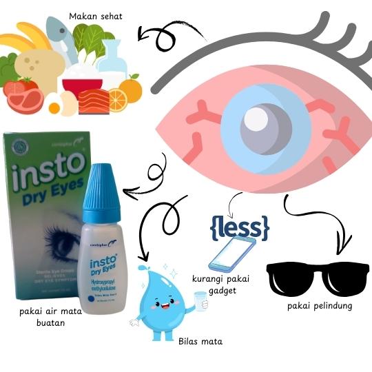 Insto Dry Eyes dan solusi praktis mata kering